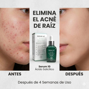 NiaGlow S10 serum Anti-Acné con acido salicilico