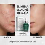 NiaGlow S10 serum Anti-Acné con acido salicilico